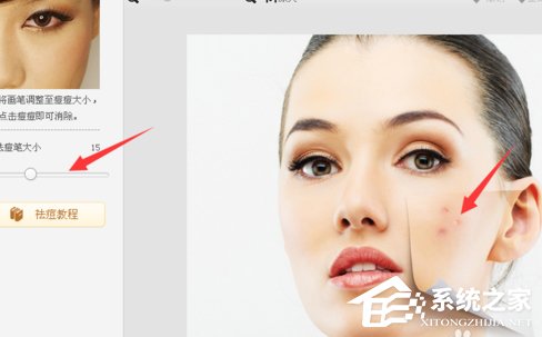 美圖秀秀怎么去除痘痘？美圖秀秀去除痘痘的方法
