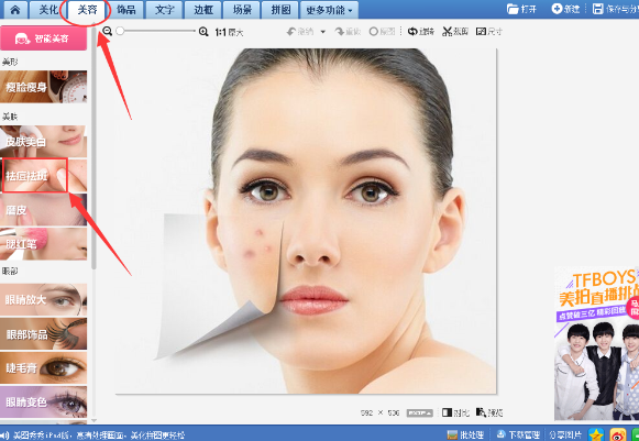 美圖秀秀怎么去除痘痘疤痕？美圖秀秀去除痘痘疤痕圖文教程