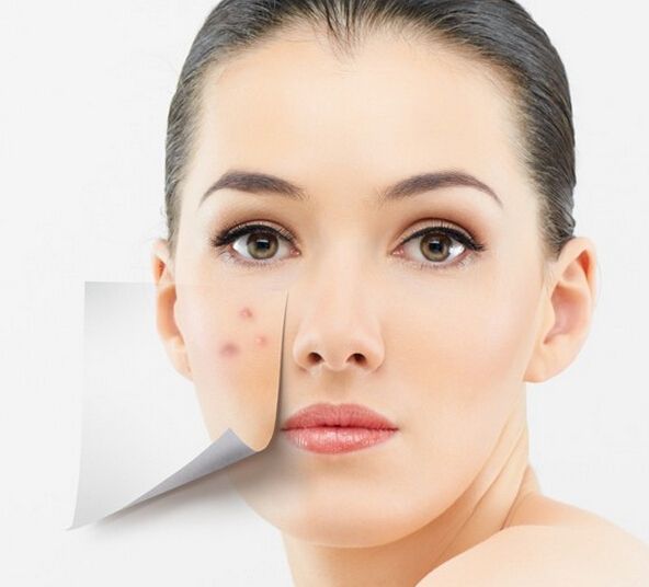 美圖秀秀怎么去除痘痘疤痕？美圖秀秀去除痘痘疤痕圖文教程