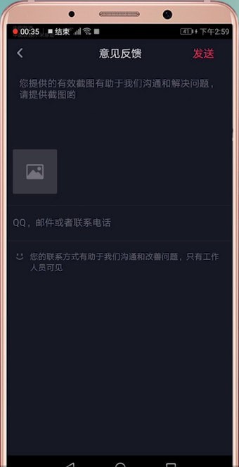 在抖音里怎么聯(lián)系客服?聯(lián)系客服的方法說明